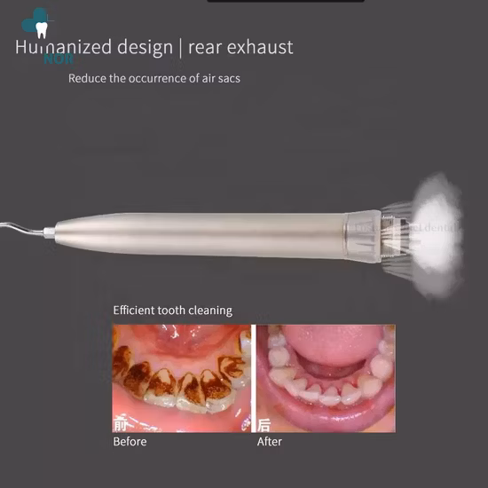 Détartreur dentaire à Air de Type Kavo, outils de polissage, nettoyeur de blanchiment des dents avec 3 embouts